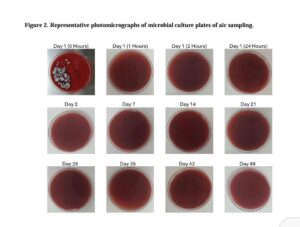 Microbial Culture Test Results